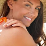 Sunburn: How to lighten the skin burnt by the sun rays?